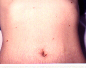 2mmfrau.jpg (20723 Byte)